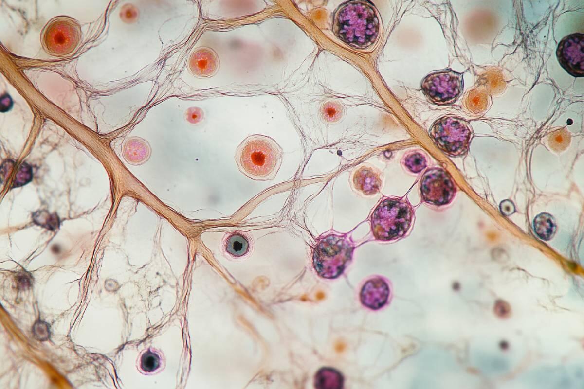 Wiederkehrende Vaginalpilzinfektionen: Ursachen und Prävention