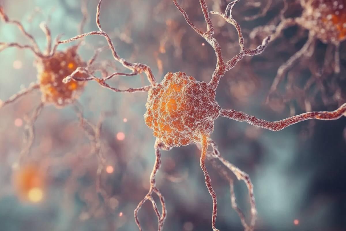 Parkinson: Fortschritte in der Genforschung und ihre Bedeutung
